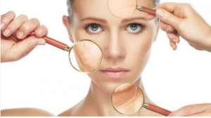 Relistase, 10 ����� ������ - ����������� 1