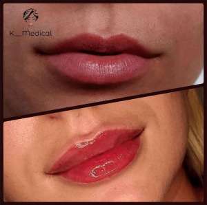 ���� ���������� � �����. - ����������� 1