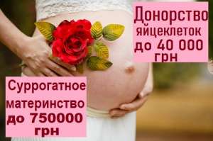 ����� ������������ ����������� "SURmamka" ���������. - ����������� 1