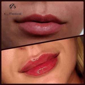 ������ ����� ����������� � ����� - ����������� 1