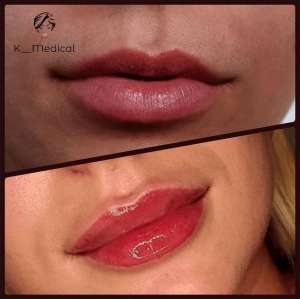 ������ ����������� � ����� - ����������� 1