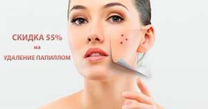 �������� �������� �� ����� - ����������� 1