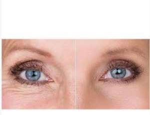 ��������� ������ �������� ���� - ����������� 1