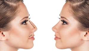 ������������ � Perfecto Room � �. ����. - ����������� 1