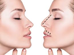 ������������ � ������� ������������� ������� ������ �������� - ����������� 1