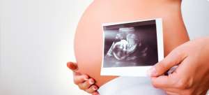 ������������ ����������� - ����������� 1